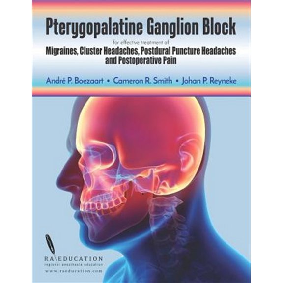 Pre-Owned Pterygopalatine Ganglion Block: for effective treatment of Migraine, Cluster Headache, Postdural (Paperback) by Cameron R Smith, Johan P Reyneke, Andre P Boezaart
