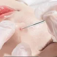 thumbnail image 4 of 3-8Pcs Blackhead Clip Pimples Tweezer Blackhead Remover Stainless Steel Cell Clip Beauty Product Acne Needle Skin Cleanning Tool, 4 of 10