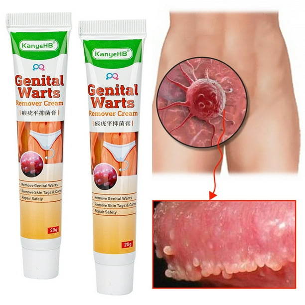 Crema para eliminar verrugas de 20g ingredientes naturales crema para tratamiento de condiloma acuminatum multiusos rápida y eficaz para todo tipo de piel