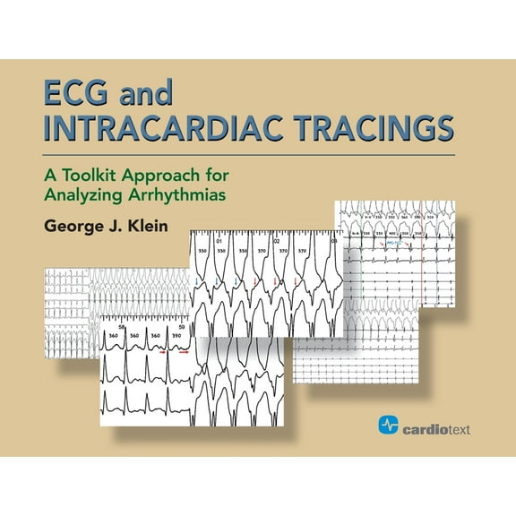 ECG and Intracardiac Tracings: A Toolkit Approach for Analyzing Arrhythmias, (Paperback)