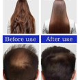 thumbnail image 3 of Acondicionador para el cabello con aceite de Batana, nutritivo y reparador, fortalece las raíces, previene la caída del cabello, suaviza el cabello, acondicionador para el cuidado del cabello, 3 of 4