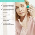thumbnail image 2 of Inicio Kit de microdermoabrasión PMD Microderm Classic para rostro, 2 of 9