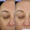 thumbnail image 4 of Acondicionador Shaan Honq SH-RD Nutra-Therapy 250 ml Shaan Honq, 4 of 5