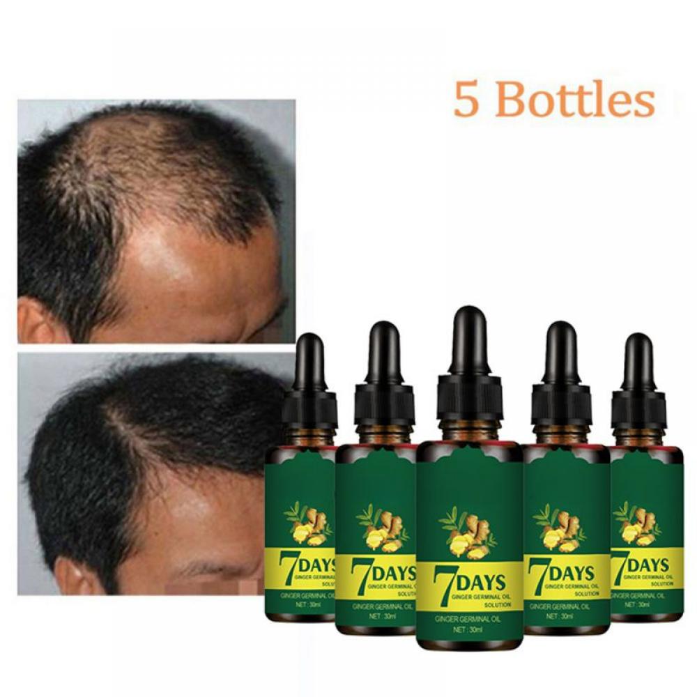 Ginger Essential Oil Hair Regrow 7 Day Germinal Oil Hair Growth Serum Anti Hair Loss 6937