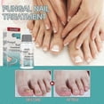 thumbnail image 1 of EELHOE Fungal Nail Treatment Liquid Nail Repair Moisturizing Anti-Hangnail Care Solution Cuticle Cream & Oil1PCS) -, 1 of 5