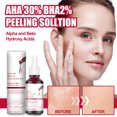 thumbnail image 2 of Suero exfoliante suave para una piel más suave: Solución exfoliante AHA 30% + BHA 2%, 2 of 8