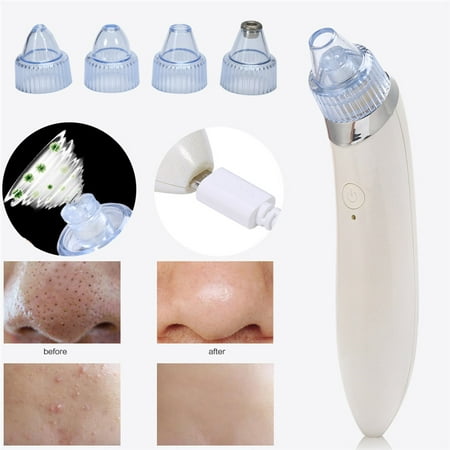 Blackhead Acne Vacuum Suction Remover Device Electric Skin Cleanser Blackhead Extractor Tool Pore Cleaner with 4 Replaceable Suction Heads Beauty Machine Rechargeable (Best Acne Red Mark Remover)