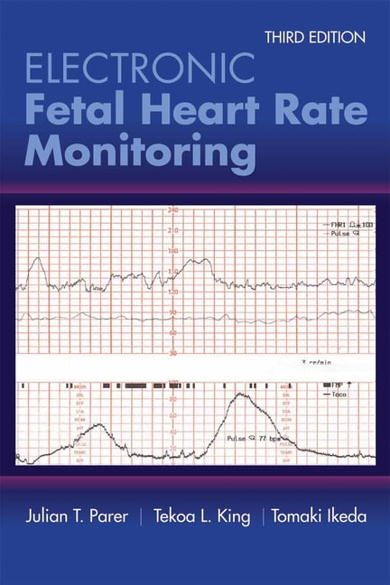 fetal heart rate monitor walmart