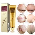thumbnail image 2 of 30g Crema Para Eliminar Cicatrices Blanqueamiento Hidratante Marca De Acné Removedor De Estrías De Espinillas ANGGREK Otros, 2 of 8