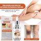 thumbnail image 3 of Pack of 2 Acanthosis Nigricans Treatment Oil 50ml, 3 of 4