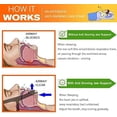 thumbnail image 4 of Anti Snoring Chin Strap, 4 of 5