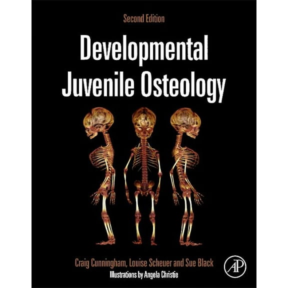 Developmental Juvenile Osteology, (Hardcover)