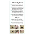 thumbnail image 3 of Lounge Doctor Inflatable Travel Leg Rest with Pump, 3 of 4