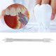 thumbnail image 5 of Localizador De Calibre De Soporte Dental Materiales Dentales Posicionador De Soporte De Ortodoncia S Monstrate CE002715-00, 5 of 7