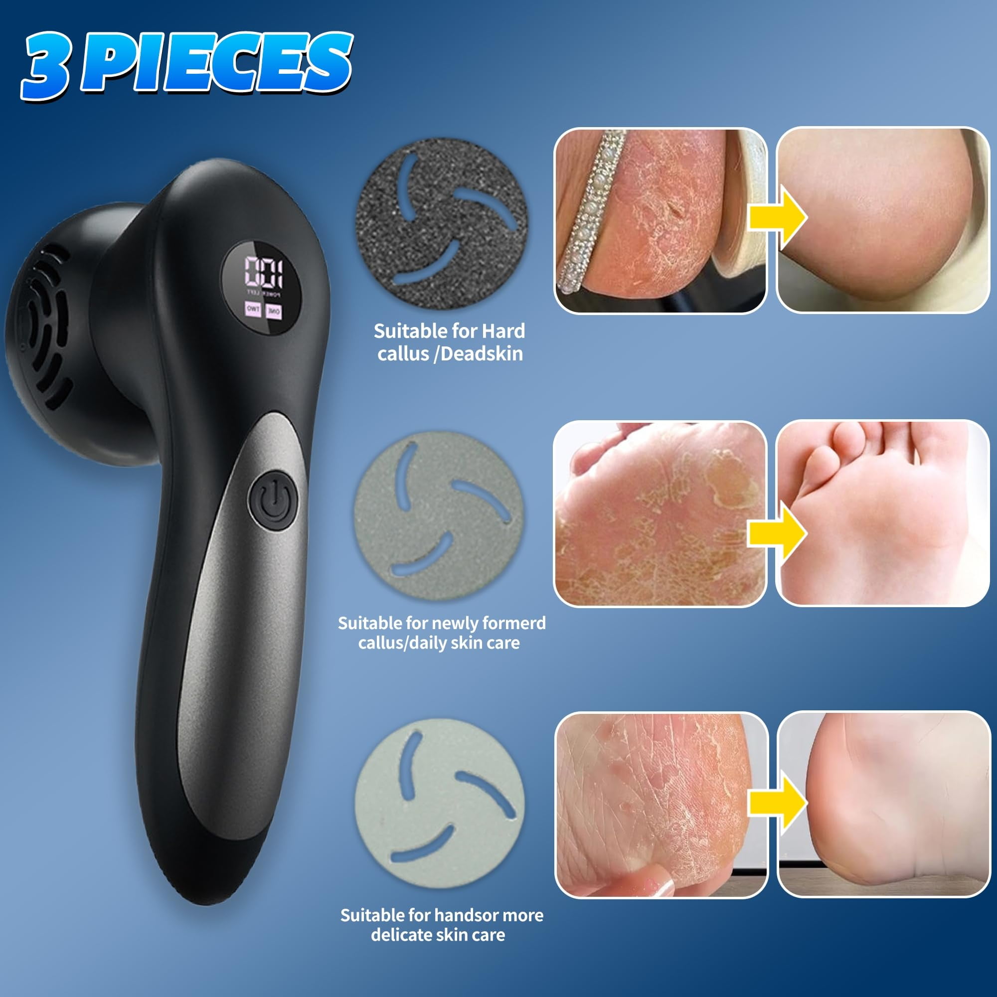 Electric Feet Foot Callus Remover Equipped with A Vacuum System Foot Scrubber Professional Foot Care Tool Waterproof for Removing Hard Cracks Dryness and Dead Skin (Black)
