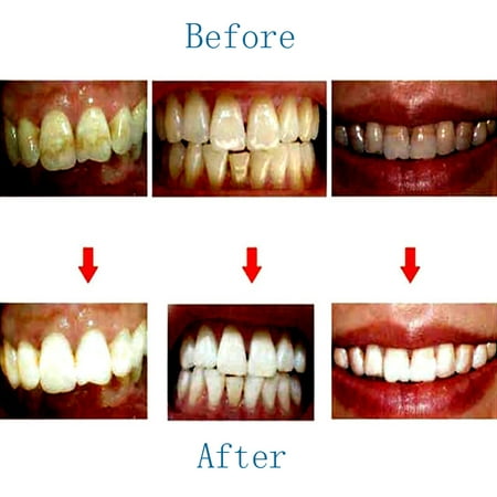Toothpaste Whitening Teeth Care Remove Halitosis Plaque Dentifrice Cleaning