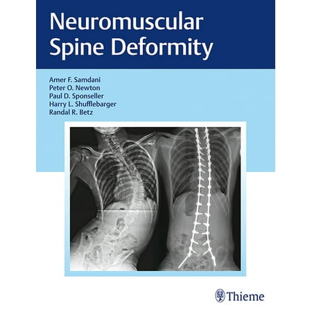UPC: 9781626232600 | Neuromuscular Spine Deformity (Hardcover)