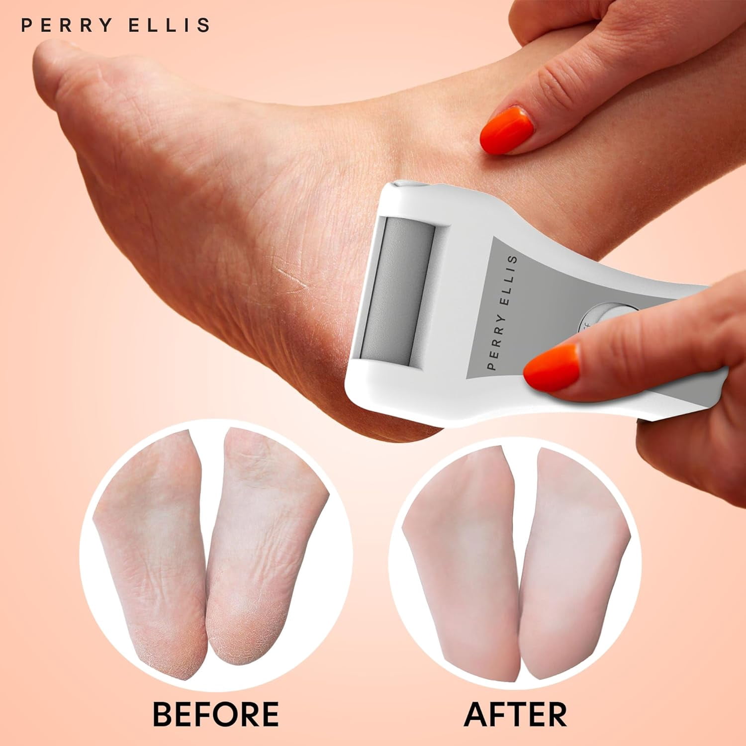 Perry Ellis Electric Callus Remover for Feet, Cordless and Portable Foot File Kit with 3 Pumice-Stone Heads, Cleaning Brush, Child-Safety Lock, and Protective Cap, 2,000 RPM, Batteries Not Included