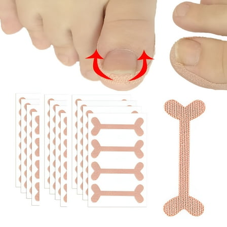 XIRQI Ingrown Toenail Treatment, 50pcs Ingrown Toenail Corrector Patches, Health Toenail Correction Stickers, Professional Glue-Free Toe Nail Treatment Tool, Foot care