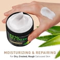 thumbnail image 4 of Crema para pies New York Biology con 42% de urea y 2% de ácido salicílico, 120 ml, 4 of 7