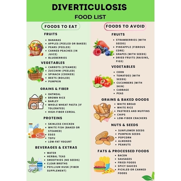Diverticulitis Friendly Foods Printable - High Fiber Diet Chart for Colon Health, Diverticulosis Eat Avoid List Poster Unframed12x18inch(30x45cm)
