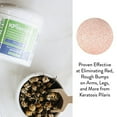 thumbnail image 4 of KP Elements Exfoliating & Soothing Skin Cream Keratosis Pilaris, 4 fl oz., 4 of 6