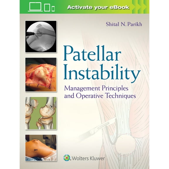 Patellar Instability: Management Principles and Operative Techniques, (Hardcover)