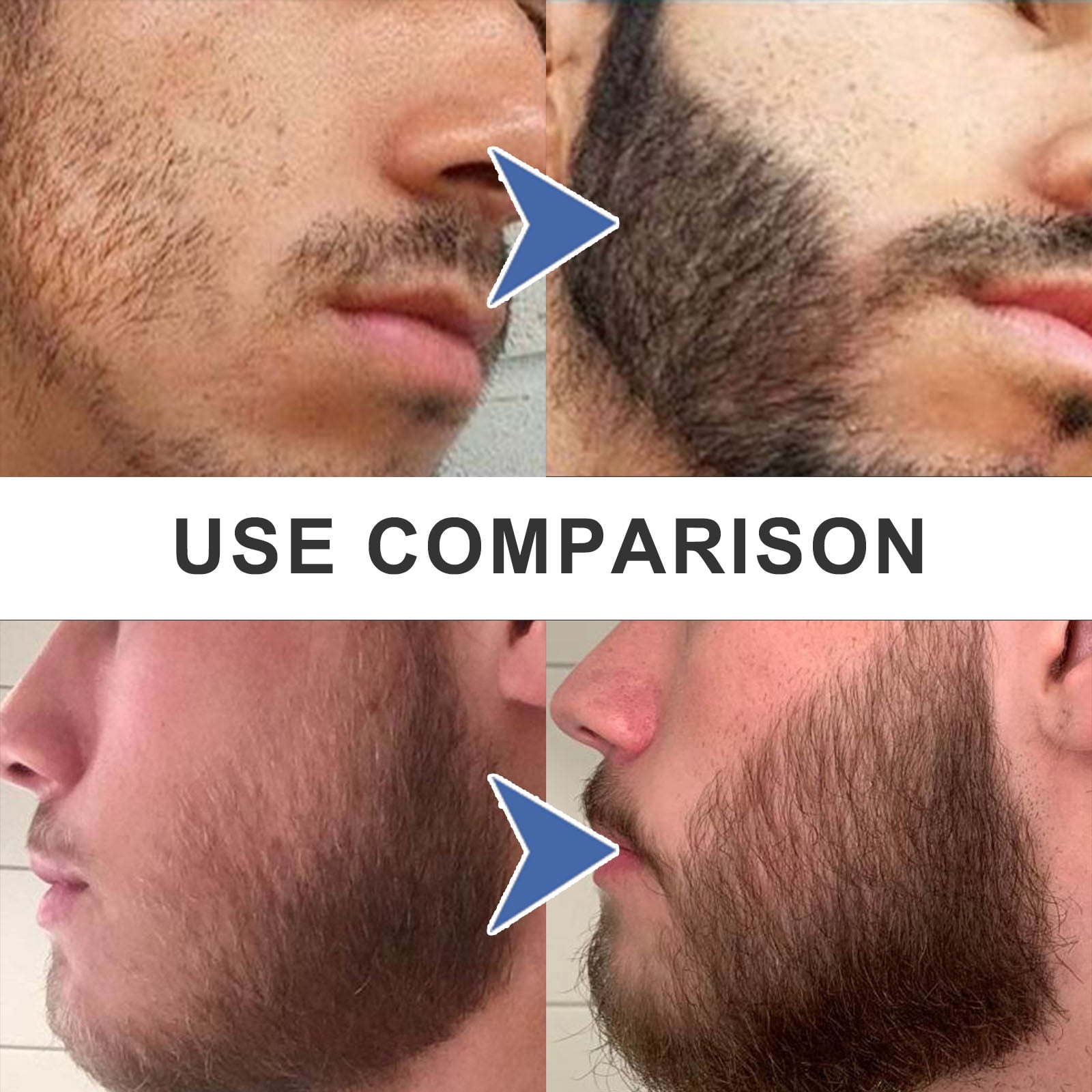 Alvantor Beard Pen Filler Kit for Men - Waterproof & Sweat Proof Facial Hair Enhancer