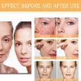 thumbnail image 5 of Great Promotion Glycolic Sour 7% Toner Exfoliate And Rejuvenate Your Skin Solution For Blemishes And Acne For The Skin Barrier Improves Blemishes And Acne Shrinks Pore(100ml） Beauty Personal Care, 5 of 5