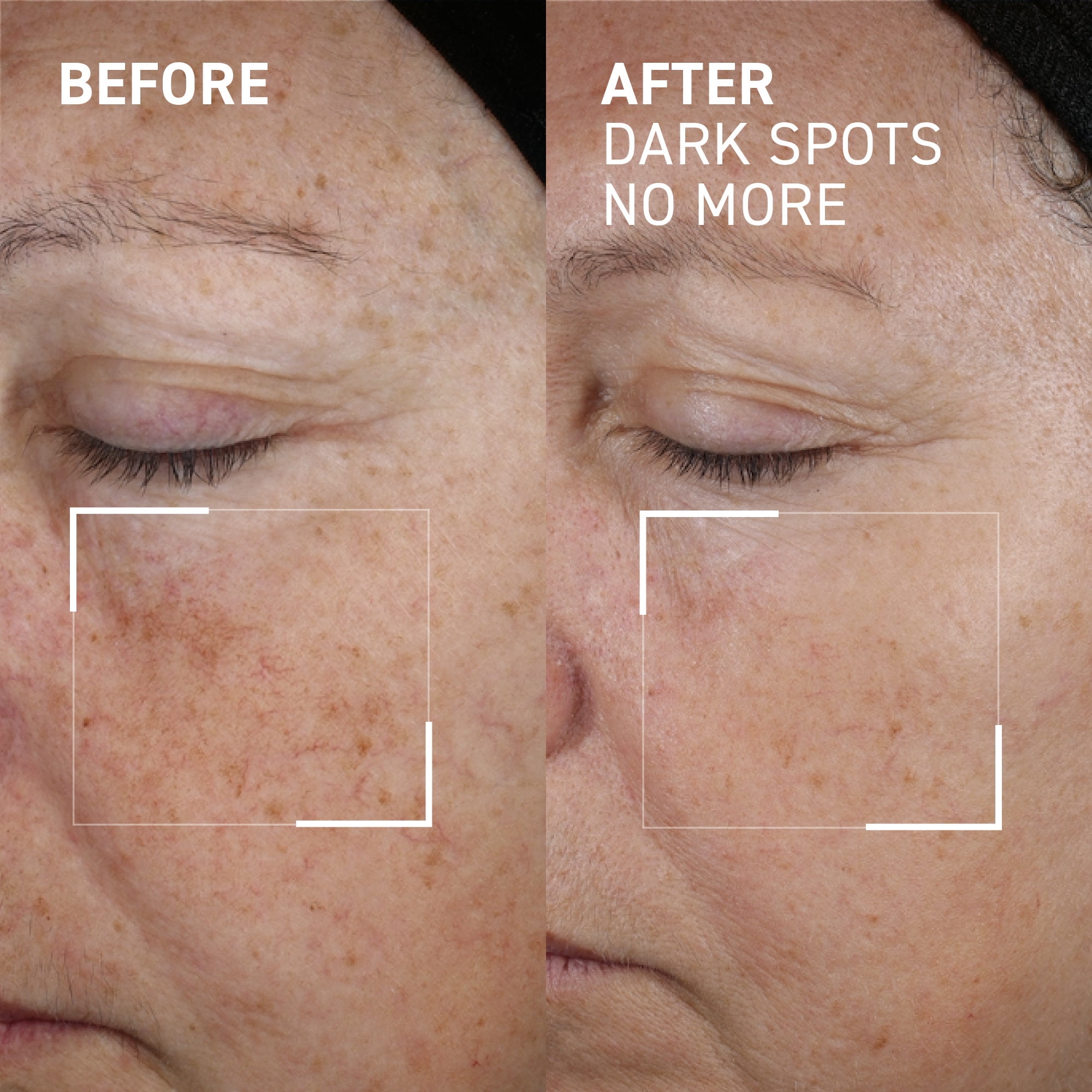 Dr. Brandt Dark Spots No More