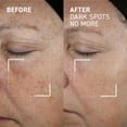 thumbnail image 2 of Dr. Brandt Dark Spots No More, 2 of 6