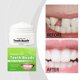 thumbnail image 1 of Pisexur Belleza Maquillaje Mordedor temporal que moldea las dentaduras postizas, dándoles una apariencia estética y restaurando fácilmente su apariencia. 30 g.para mujeres y hombres, 1 of 9