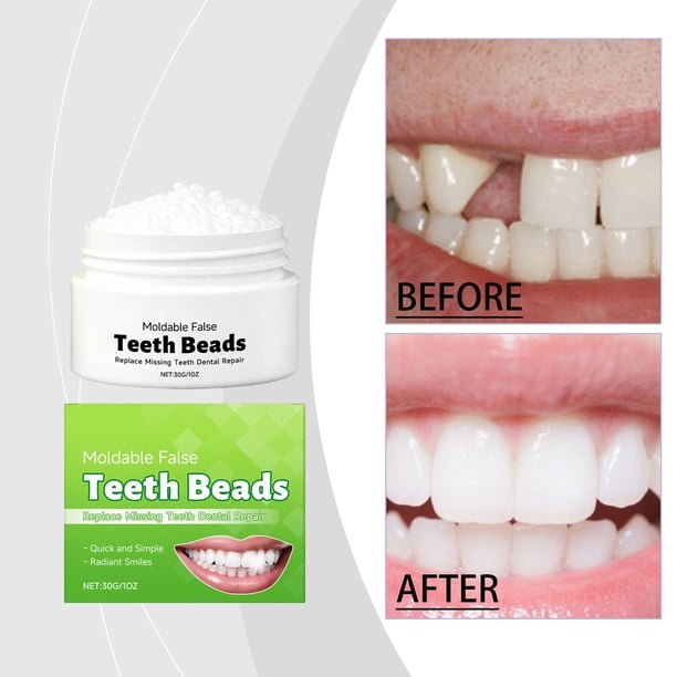 Pisexur Belleza Maquillaje Mordedor temporal que moldea las dentaduras postizas, dándoles una apariencia estética y restaurando fácilmente su apariencia. 30 g.para mujeres y hombres