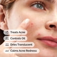 thumbnail image 2 of Tratamiento localizado The Ordinary Sulfur 10% en polvo a crema 5 g, 2 of 9