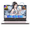 Rose Gold, variant on 15.6" IPS FHD Gaming Laptop 32GB LPDDR5 RAM 2TB SSD AMD Ryzen 7 Pro 6850U (Beat i7-1360P Up to 4.7GHz) AMD Radeon 680M GPU with 100W Type-C Backlit Keyboard Fingerprint Blue