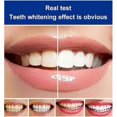 thumbnail image 3 of Sp-4 Toothpaste,sp-4 Probiotic Toothpaste,brightening & Stain Removing Toothpaste,sp-4 Brightening Toothpaste Fresh Breath Toothpaste, 3 of 5
