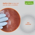 thumbnail image 6 of Medline Remedy Specialized Clear Zinc Oxide Ointment, 2.5 oz., Unscented, 6 of 11