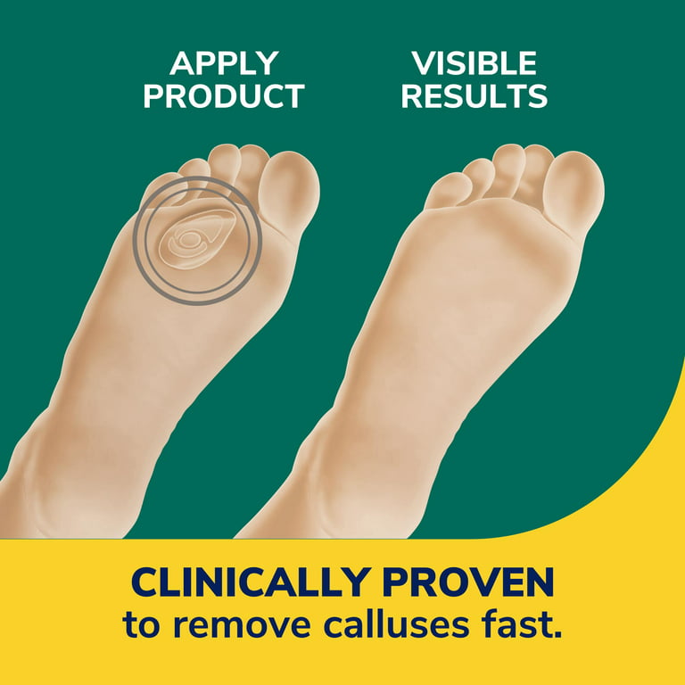 Dr. Scholl's Callus Remover Seal & Heal Bandage with Hydrogel Technology,  4ct // Removes Calluses Fast and Provides Cushioning Protection Against  Shoe