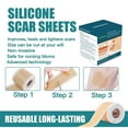 thumbnail image 2 of Silicone Scar Sheets,Silicone Scar Tape, Reusable and Effective Scar Removal Sheets, Silicone Scar Removal Sheets for Surgical Scars,Healing Keloid, C-Section, Tummy Tuck, 2 of 7