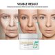 thumbnail image 2 of Crema blanqueadora y antipecas Versión en inglés aclara las manchas, hidrata y, 2 of 4