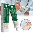 thumbnail image 1 of Crema para manos y pies con hongos, 20g, para aliviar la picazón de Beriberi, erosión y descamación de ampollas, ungüento para pies, crema hidratante para manos y pies, 1 of 8