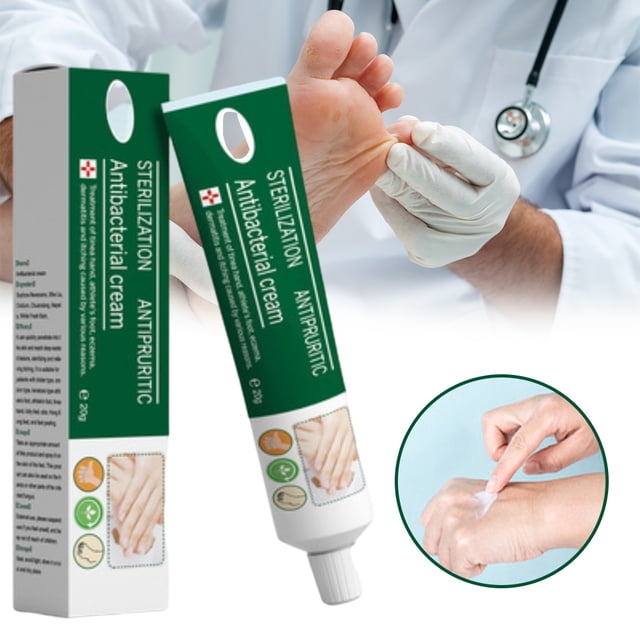 Crema para manos y pies con hongos, 20g, para aliviar la picazón de Beriberi, erosión y descamación de ampollas, ungüento para pies, crema hidratante para manos y pies