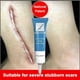 thumbnail image 2 of ScarAway Advanced Scar Gel - 15 g, crema eficaz para eliminar cicatrices de acné, estrías y quemaduras, 2 of 10