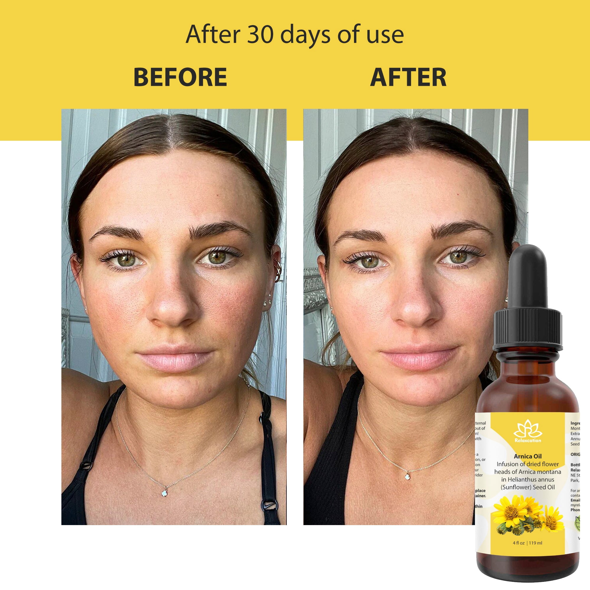 Pure Arnica Organic Oil – Unrefined, Massage & Skincare Treatment