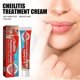 thumbnail image 2 of 2pcs Dry Cracked Lips - Healing Lip Balm for Severely Chapped Lips - Designed for Men Women and Children Cheilitis Treatment Cream, 2 of 5