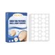 thumbnail image 5 of Seitruly Skin Set Professional Painless Warts Removing Moles Remover Labels Patch Removers Type2 NO2 Seitruly CE014754-01, 5 of 6