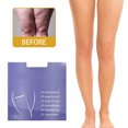thumbnail image 2 of 10 Pcs Thigh Firming Stickers Clear Adhesive Strips Instantly Cellulite and Sagging Skin, 2 of 8