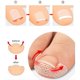 thumbnail image 2 of Parche para uñas encarnadas, parche aislante para surcos de uñas, corrector de perforación de uñas, juego de herramientas de pedicura, 10 piezas por pieza, 2 of 4