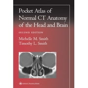 Radiology Pocket Atlas Pocket Atlas of Normal CT Anatomy of the Head and Brain, (Paperback)