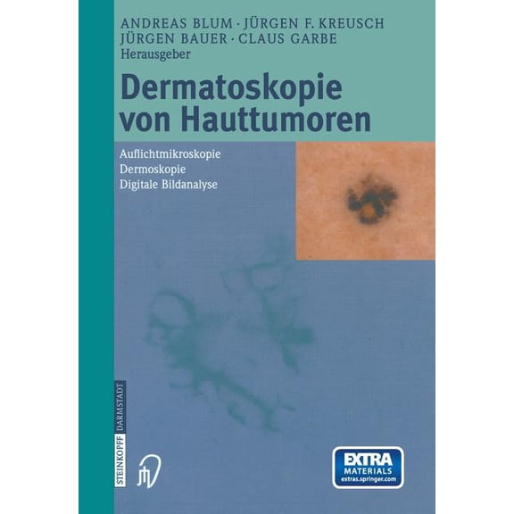 Dermatoskopie Von Hauttumoren: Auflichtmikroskopie -- Dermoskopie -- Digitale Bildanalyse, (Paperback)